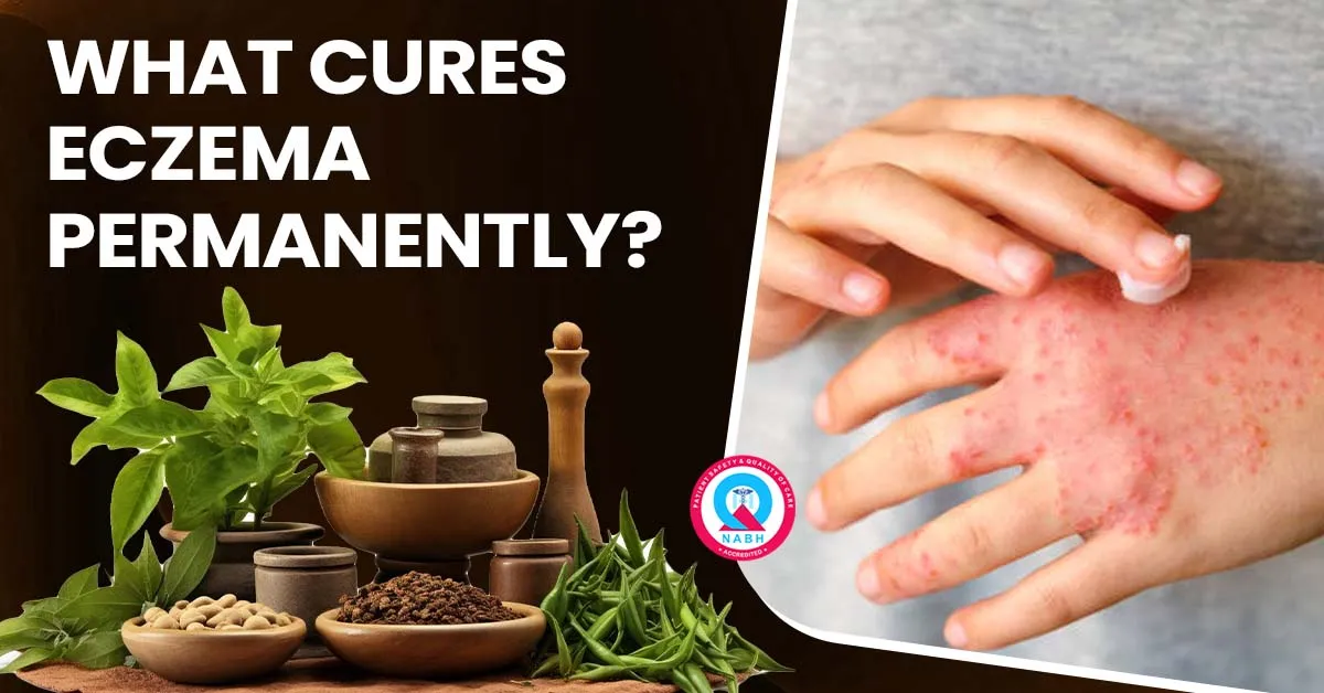 what-cures-eczema-permanently